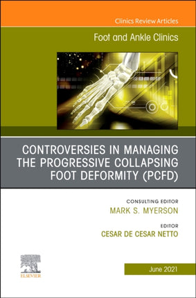 Controversies in Managing the Progressive