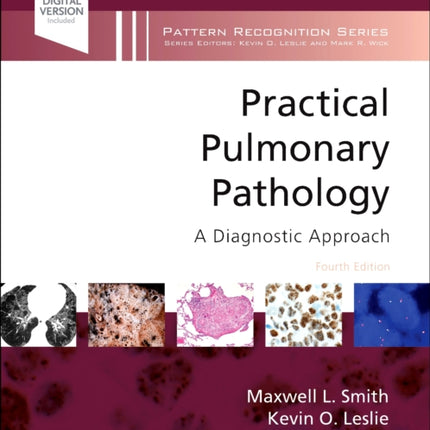 Practical Pulmonary Pathology: A Diagnostic Approach