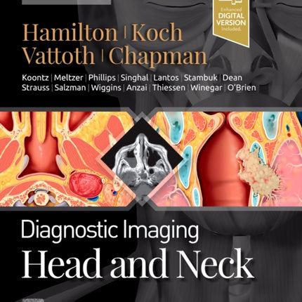 Diagnostic Imaging: Head and Neck