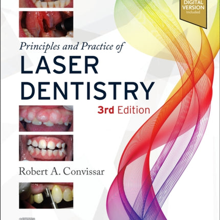 Principles and Practice of Laser Dentistry