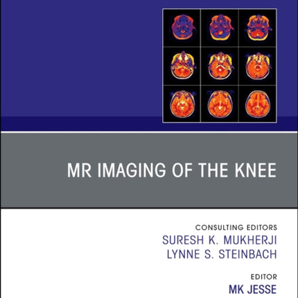 MR Imaging of The Knee An Issue of Magnetic