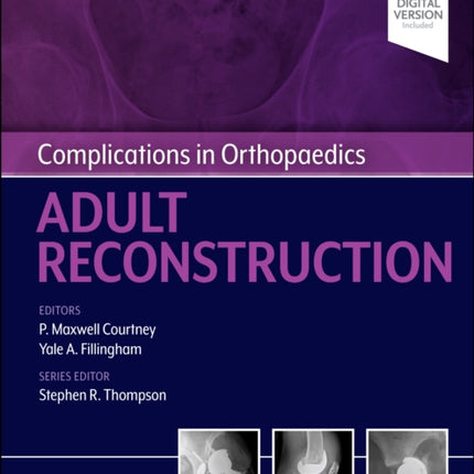 Complications in Orthopaedics: Adult Reconstruction