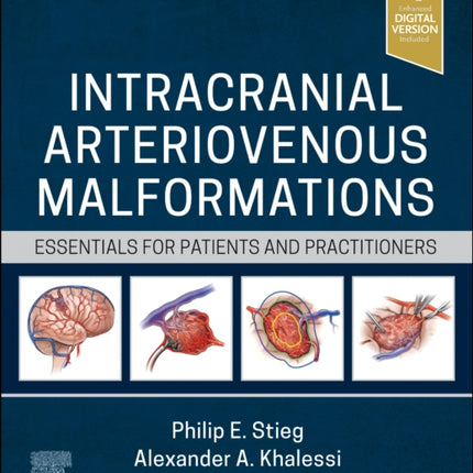 Intracranial Arteriovenous Malformations: Essentials for Patients and Practitioners