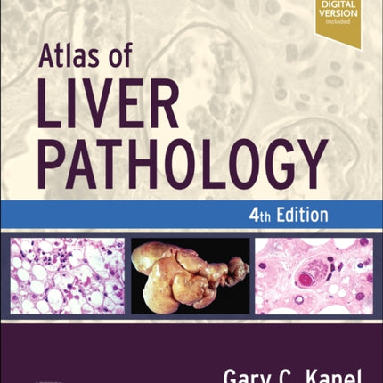 Atlas of Liver Pathology