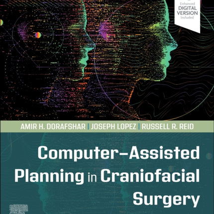 Computer-Assisted Planning in Craniofacial Surgery