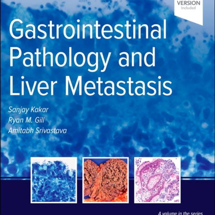 Gastrointestinal Pathology and Liver Metastasis A CaseBased Approach to Diagnosis