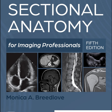 Sectional Anatomy for Imaging Professionals