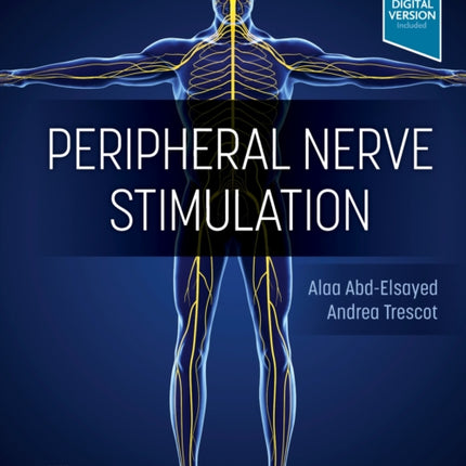 Peripheral Nerve Stimulation: A Comprehensive Guide