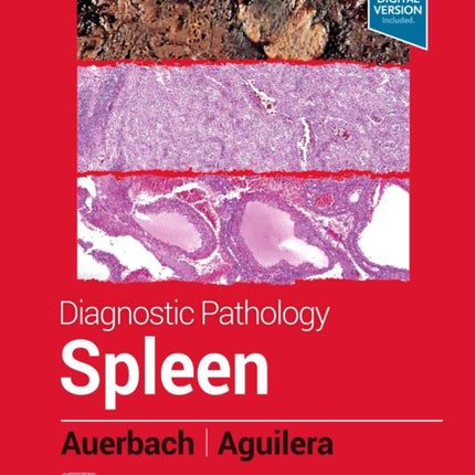 Diagnostic Pathology: Spleen