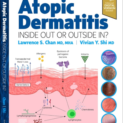 Atopic Dermatitis: Inside Out or Outside In