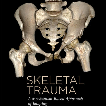 Skeletal Trauma: A Mechanism-Based Approach of Imaging