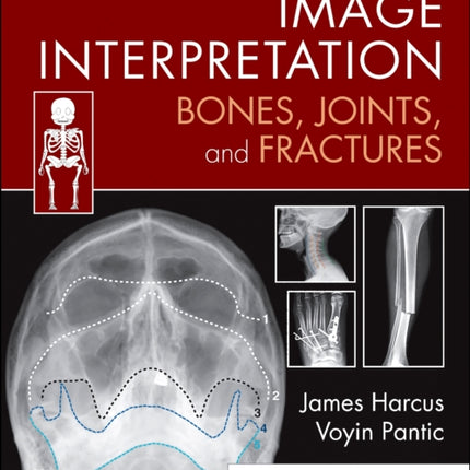 Image Interpretation: Bones, Joints, and Fractures