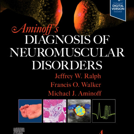 Aminoffs Diagnosis of Neuromuscular Disorders