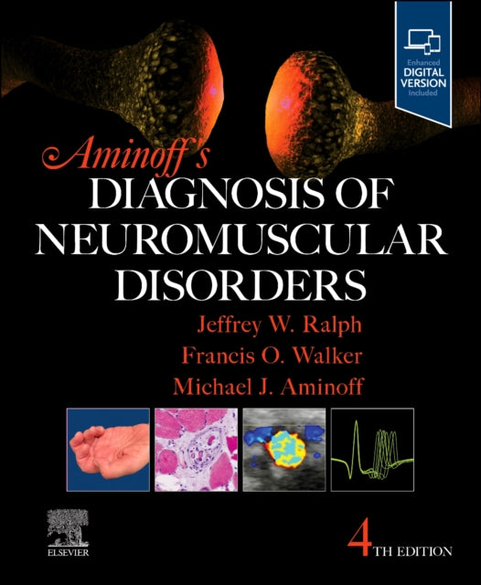 Aminoffs Diagnosis of Neuromuscular Disorders