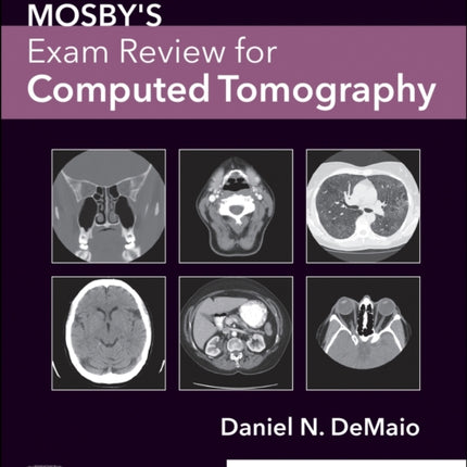 Mosbys Exam Review for Computed Tomography