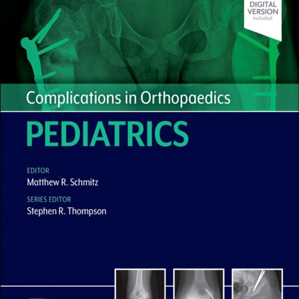 Complications in Orthopaedics: Pediatrics