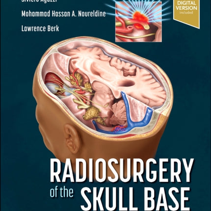 Radiosurgery of the Skull Base: A Case-Based Approach