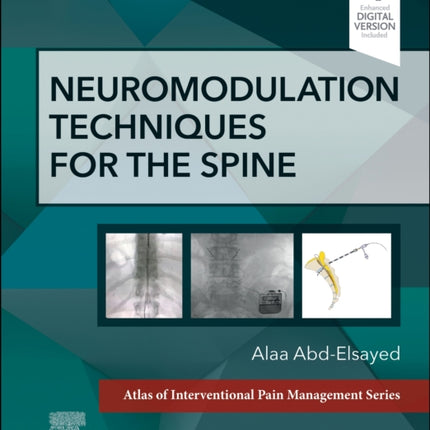 Neuromodulation Techniques for the Spine: A Volume in the Atlas of Interventional Pain Management Series