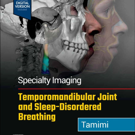 Specialty Imaging: Temporomandibular Joint and Sleep-Disordered Breathing