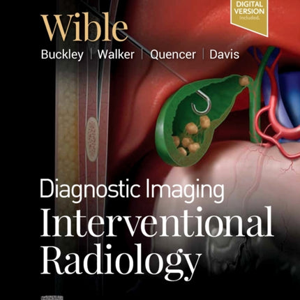 Diagnostic Imaging: Interventional Radiology