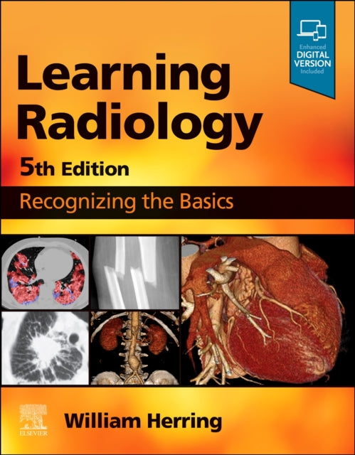 Learning Radiology: Recognizing the Basics