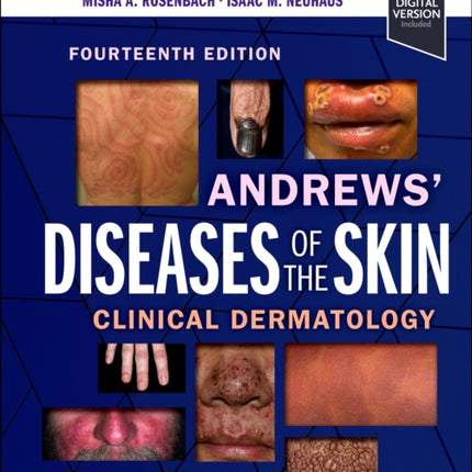 Andrews Diseases of the Skin