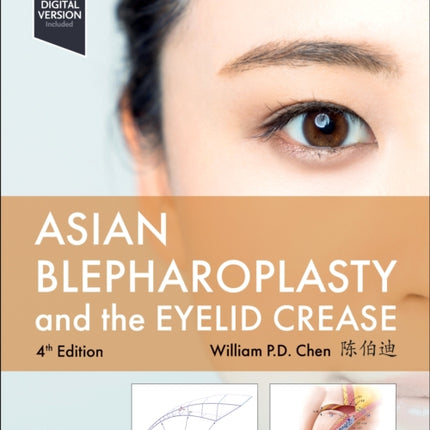 Asian Blepharoplasty and the Eyelid Crease