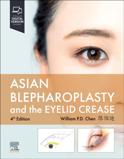 Asian Blepharoplasty and the Eyelid Crease