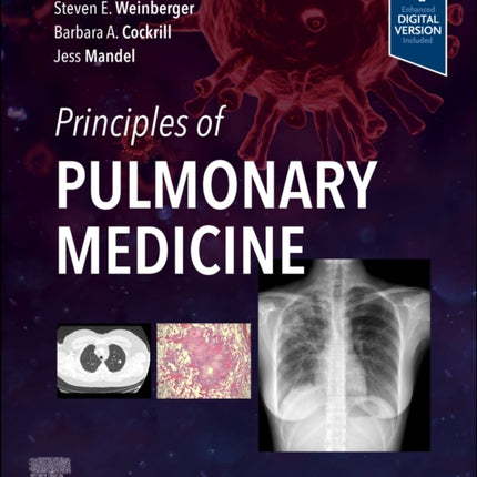 Principles of Pulmonary Medicine