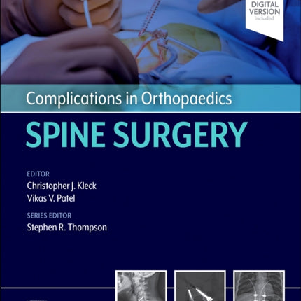 Complications in Orthopaedics Spine Surgery