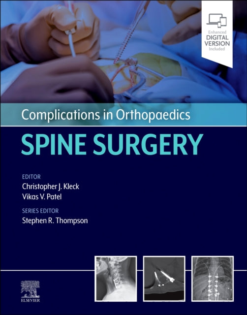 Complications in Orthopaedics Spine Surgery