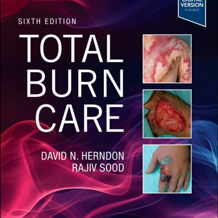 Total Burn Care