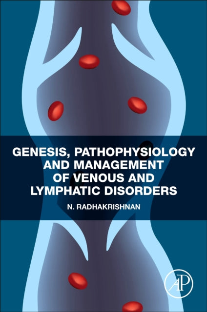 Genesis Pathophysiology and Management of Venous