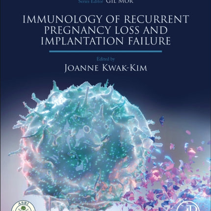 Immunology of Recurrent Pregnancy Loss and Implantation Failure