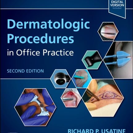 Dermatologic Procedures in Office Practice