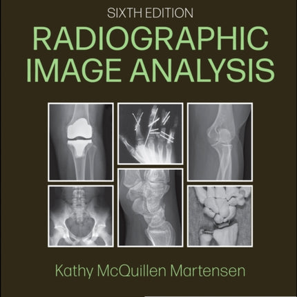 Radiographic Image Analysis