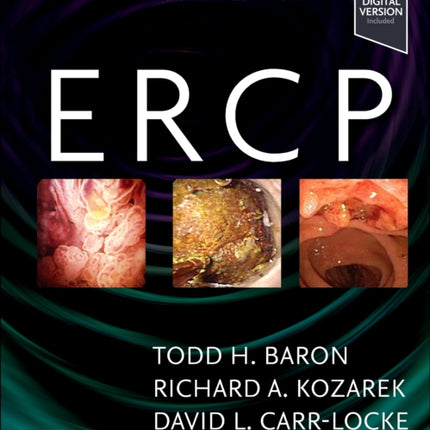 ERCP