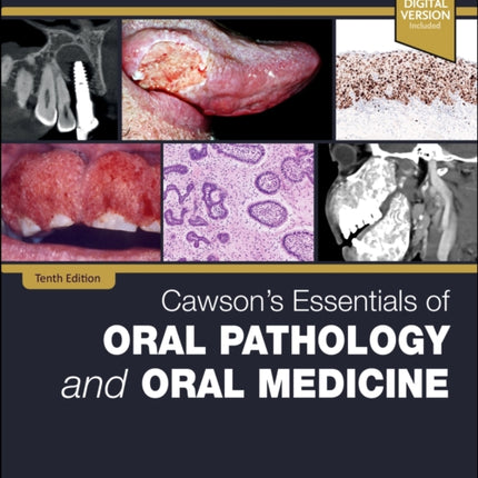 Cawsons Essentials of Oral Pathology and Oral Medicine