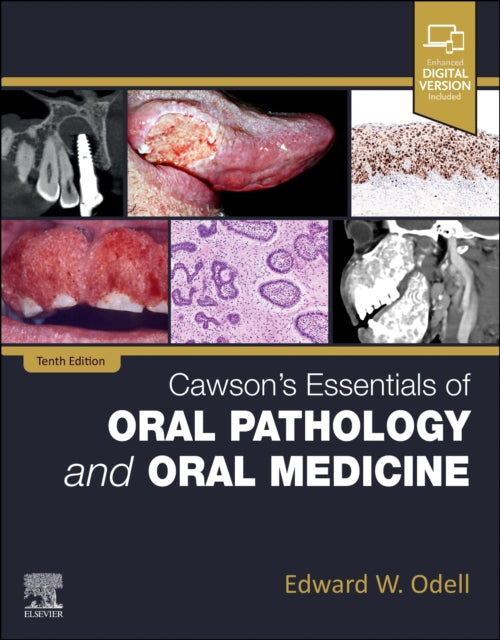 Cawsons Essentials of Oral Pathology and Oral Medicine