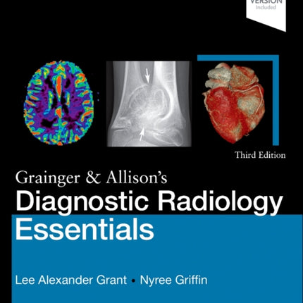 Grainger  Allisons Diagnostic Radiology Essentials