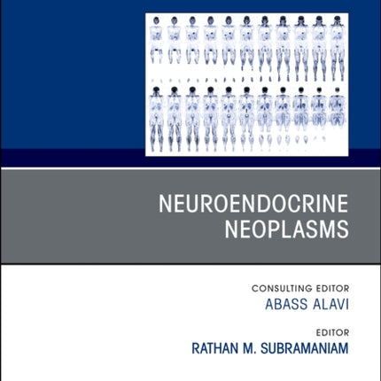 Neuroendocrine Neoplasms An Issue of PET Clinics