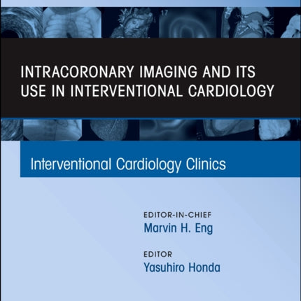 Intracoronary Imaging and its use in