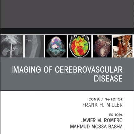 Imaging of Cerebrovascular Disease, An Issue of Radiologic Clinics of North America: Volume 61-3