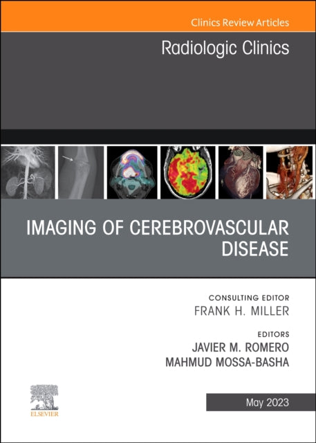 Imaging of Cerebrovascular Disease, An Issue of Radiologic Clinics of North America: Volume 61-3