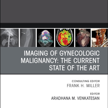 Imaging of Gynecologic Malignancy: The Current State of the Art, An Issue of Radiologic Clinics of North America: Volume 61-4