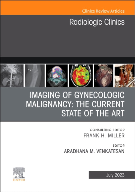 Imaging of Gynecologic Malignancy: The Current State of the Art, An Issue of Radiologic Clinics of North America: Volume 61-4