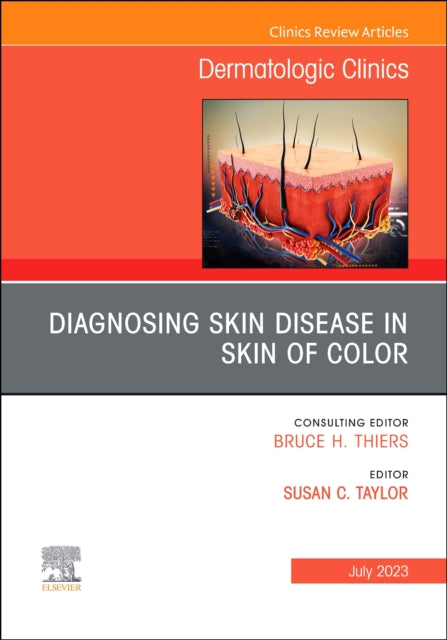 Diagnosing Skin Disease in Skin of Color, An Issue of Dermatologic Clinics: Volume 41-3