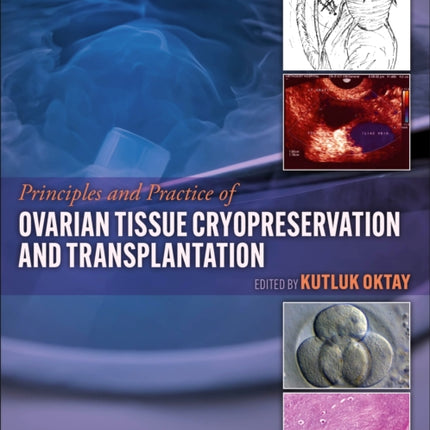 Principles and Practice of Ovarian Tissue