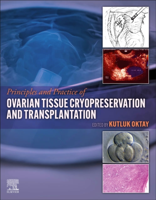 Principles and Practice of Ovarian Tissue