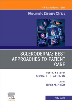 Scleroderma Best Approaches to Patient Care An